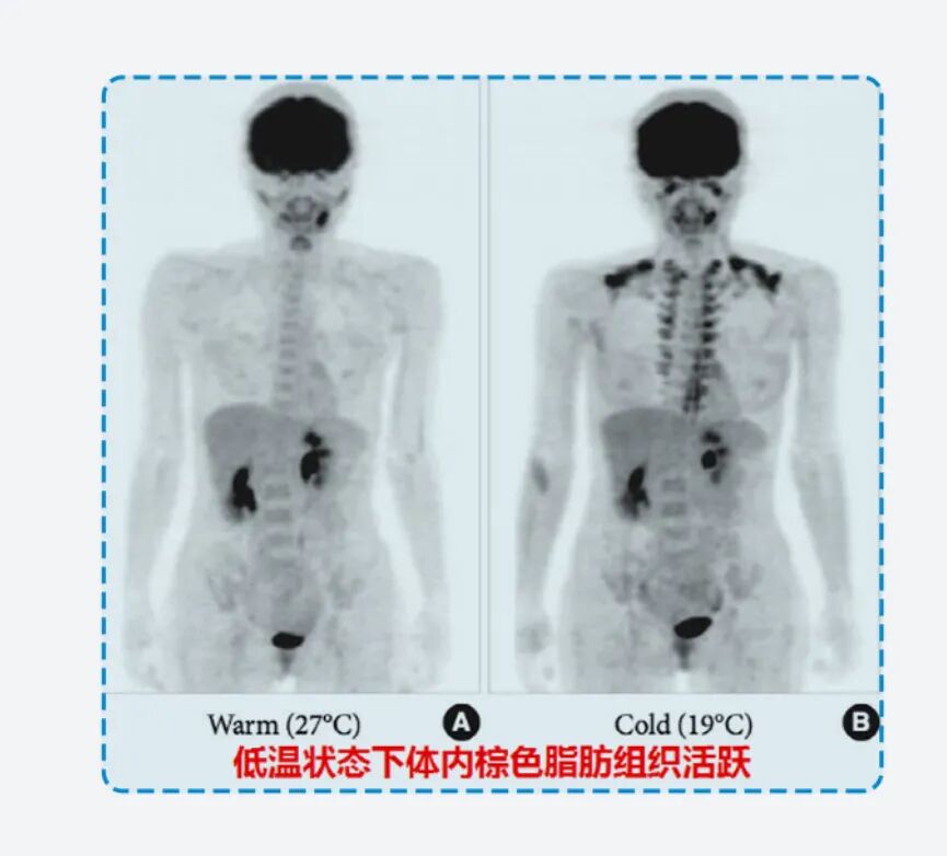 怕冷的人VS抗冻的人,哪个更健康?